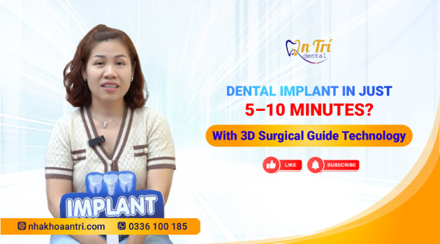 Implant placement with 3D surgical guide