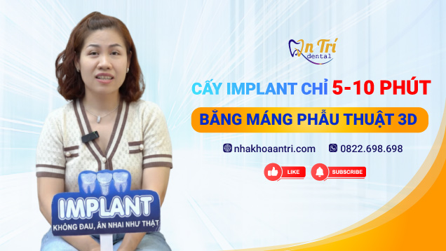 Video: Cấy Implant chỉ 5-10 phút bằng máng phẫu thuật 3D