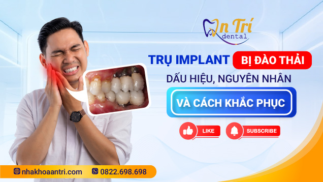 Dấu hiệu, nguyên nhân và cách khắc phục đào thải Implant