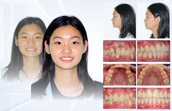 Hình: Hành trình thay đổi nụ cười 3