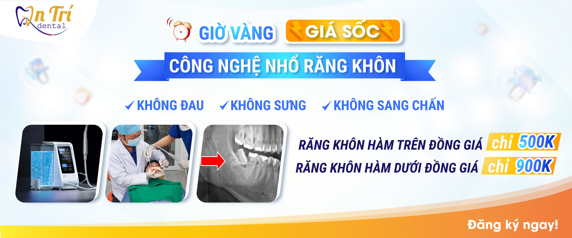 Giờ vàng giá sốc công nghệ nhổ răng khôn