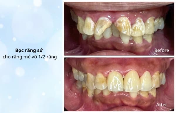 Hình: Hành trình thay đổi nụ cười 3