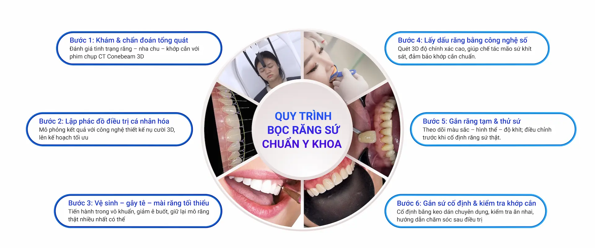 Hình: quy trình bọc răng sứ chuẩn y khoa