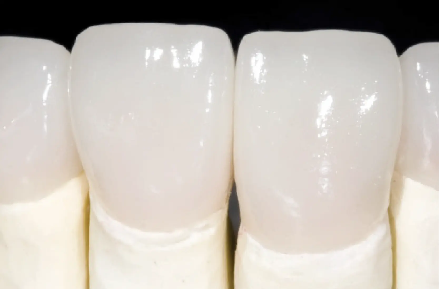 Răng sứ zirconia (Đức)