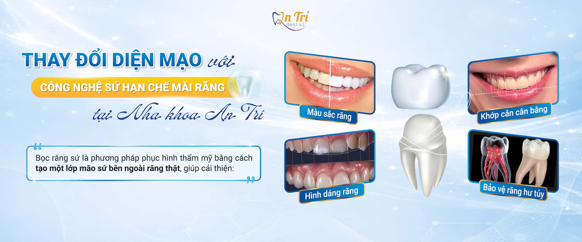 Hình: Thay đổi diện mạo với công nghệ sứ